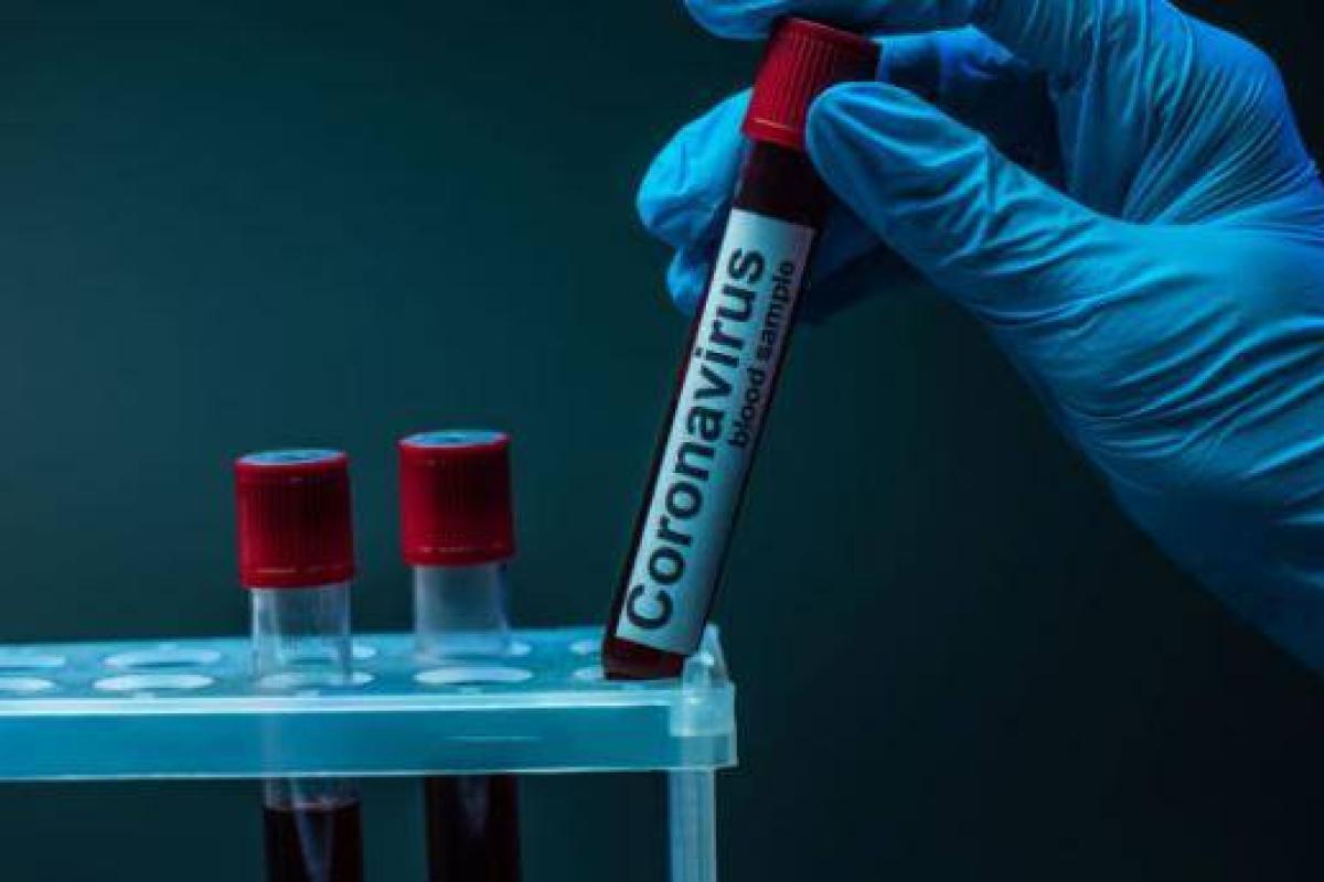 У Луганській області лабораторно підтверджено 25 нових випадків COVID-19 У Луганській області лабораторно підтверджено 25 нових випадків COVID-19