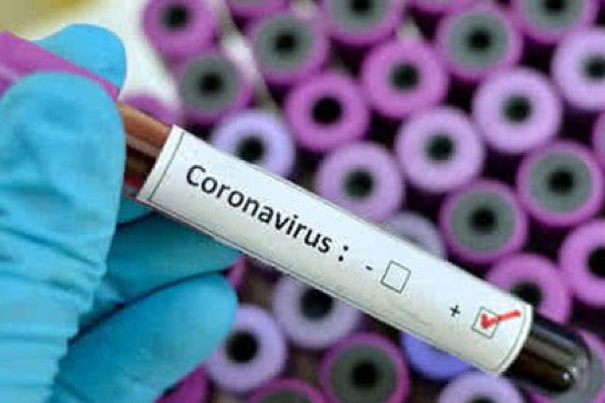 У Луганській області зафіксовано 101 новий випадок COVID-19 У Луганській області зафіксовано 101 новий випадок COVID-19