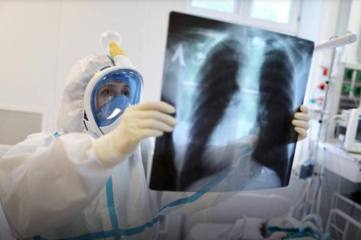 В Україні "ходить" 5 штамів коронавіруса: лікар розповіла, як змінилася симптоматика у пацієнтів В Україні "ходить" 5 штамів коронавіруса: лікар розповіла, як змінилася симптоматика у пацієнтів