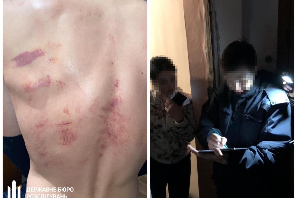 Побиття залізним стільцем та шлангом від вогнегасника: на Черкащині поліцейських підозрюють у катуванні