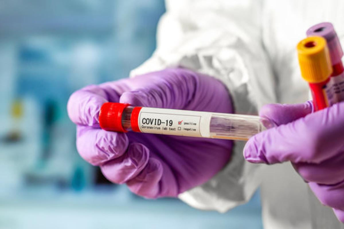 В Украине подтвердили более пяти тысяч новых случаев COVID-19