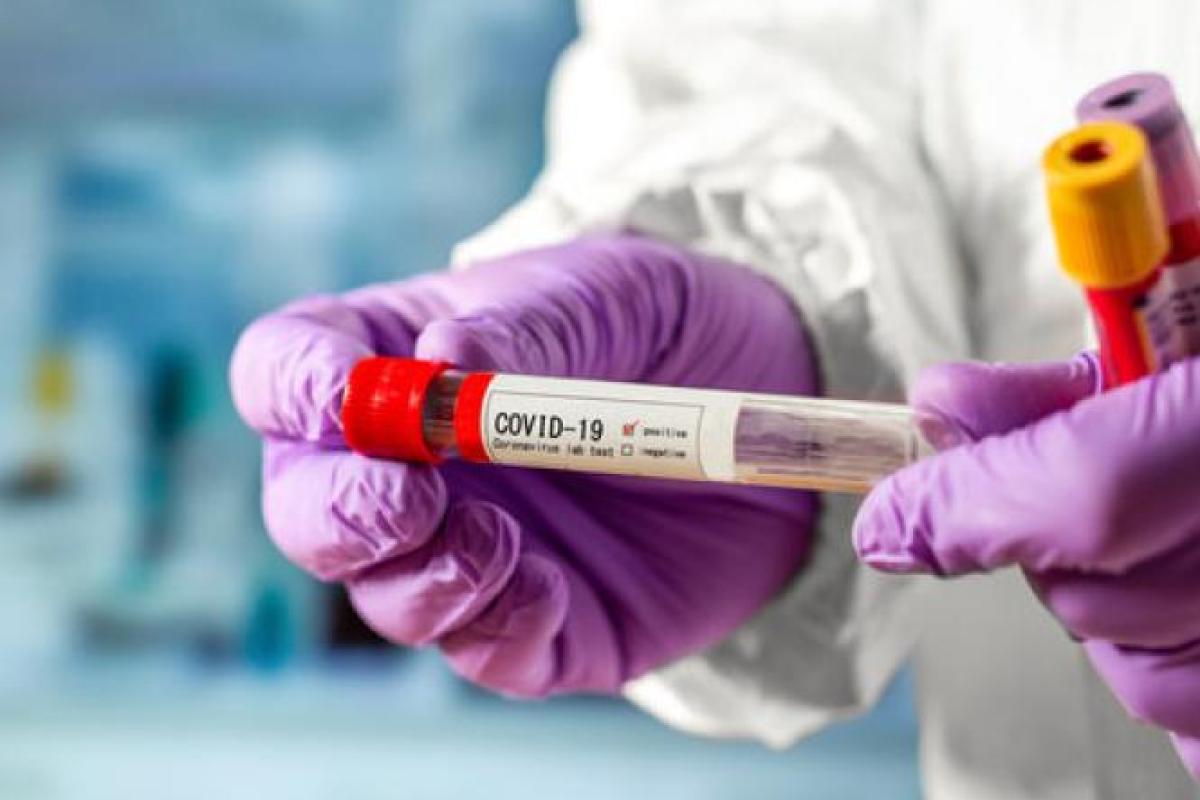 На Луганщине подтверждено 32 новых случая COVID-19 На Луганщине подтверждено 32 новых случая COVID-19