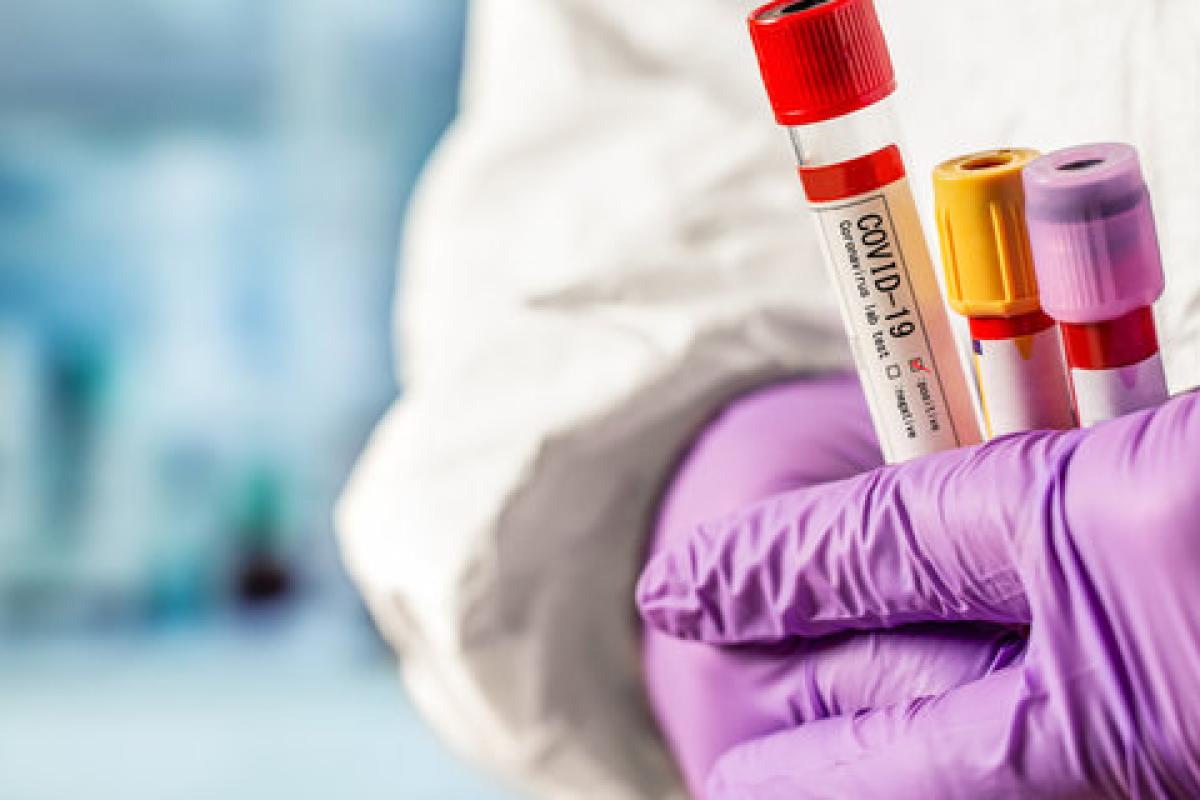В Украине зафиксировано более семи тысяч новых случаев COVID-19 В Украине зафиксировано более семи тысяч новых случаев COVID-19