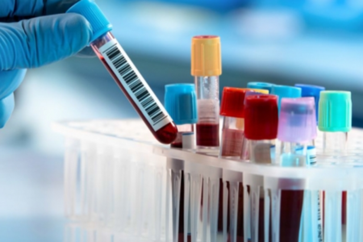 На Луганщине от осложнений COVID-19 за сутки умерли 9 больных