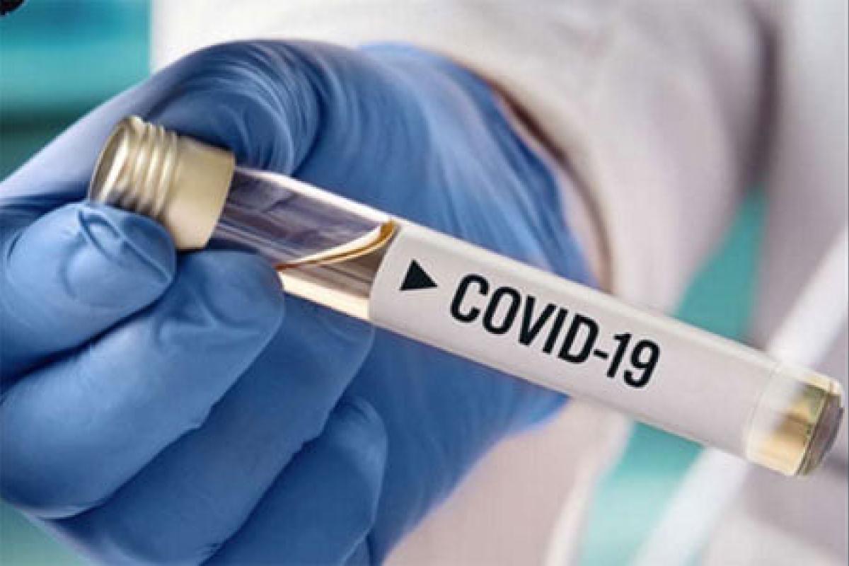 На Луганщині лабораторно підтверджено 72 нових випадки COVID-19 На Луганщині лабораторно підтверджено 72 нових випадки COVID-19