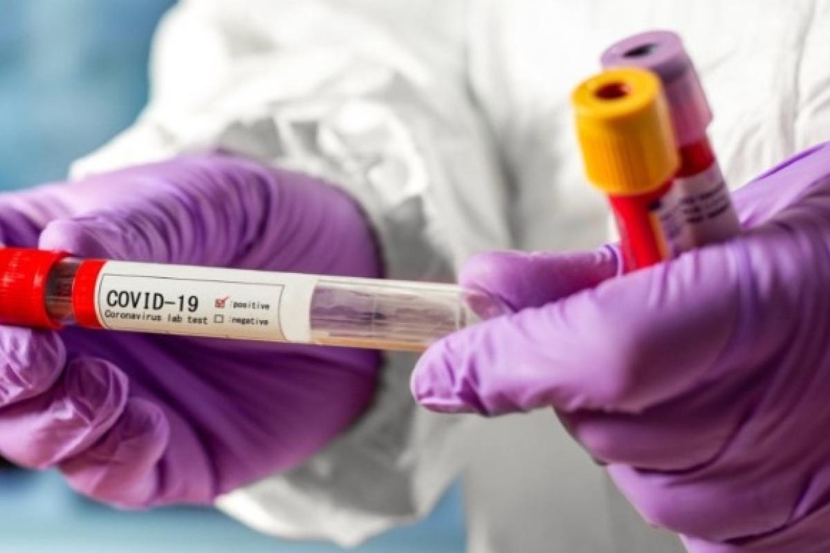 За добу в Україні зафіксовано 10 282 нових випадки COVID-19 За добу в Україні зафіксовано 10 282 нових випадки COVID-19