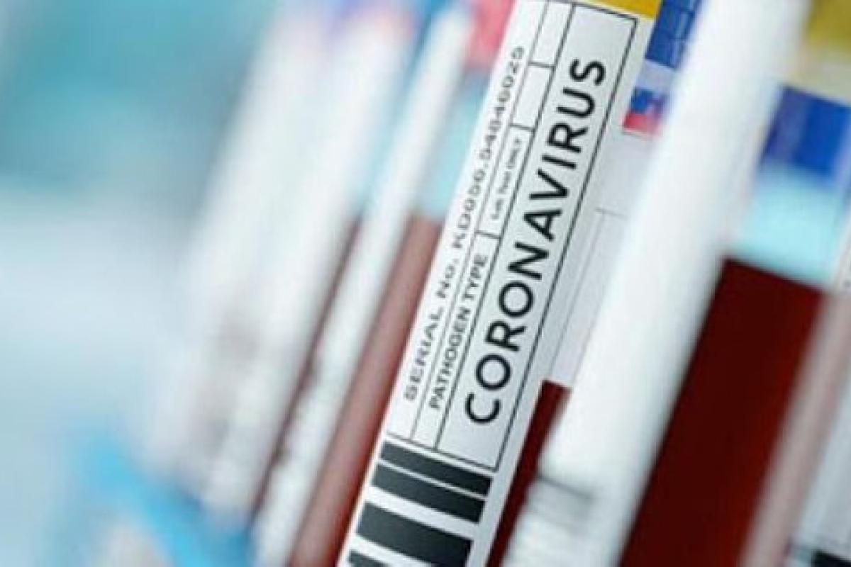 В Україні зафіксовано 5094 нових випадків COVID-19 В Україні зафіксовано 5094 нових випадків COVID-19