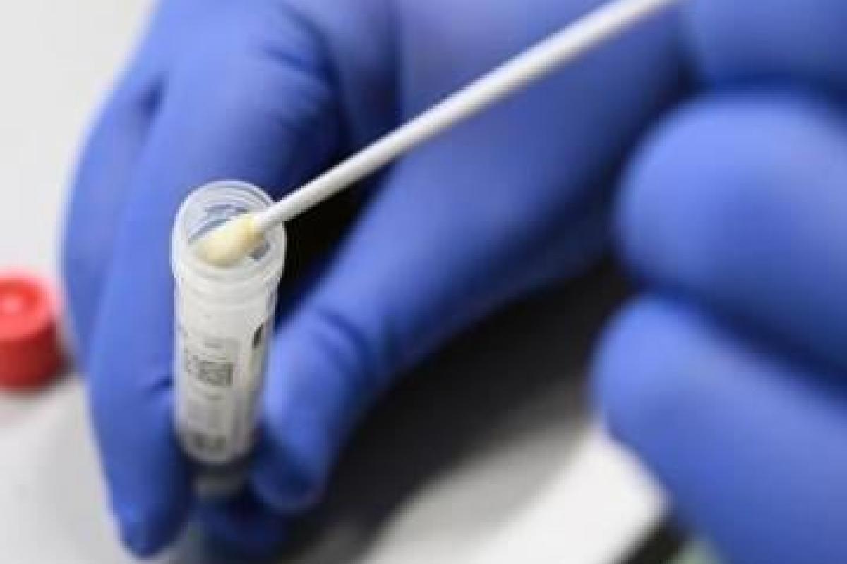 На Луганщине зафиксировано 35 новых случаев COVID-19 На Луганщине зафиксировано 35 новых случаев COVID-19