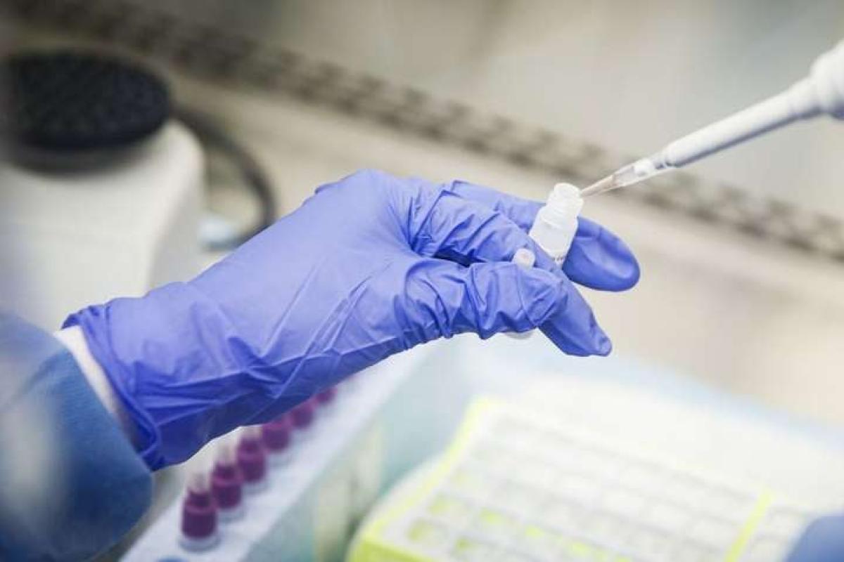 У Луганській області підтверджено 22 нових випадки COVID-19 У Луганській області підтверджено 22 нових випадки COVID-19