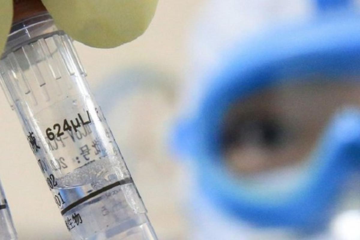 В Україні від COVID-19 вакцинували понад 83 тисячі осіб за добу В Україні від COVID-19 вакцинували понад 83 тисячі осіб за добу