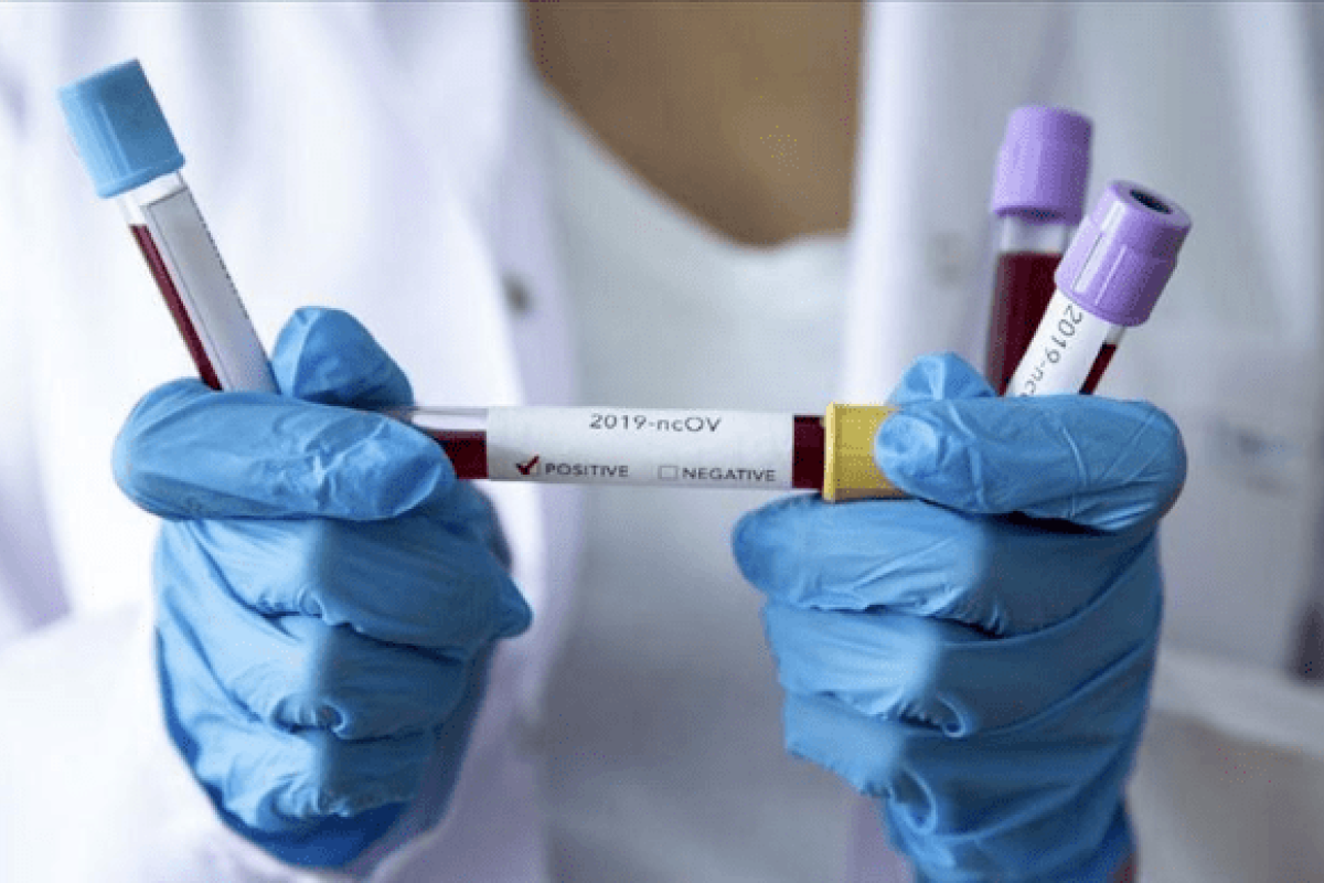 В Україні зафіксовано 4647 нових випадків COVID-19 В Україні зафіксовано 4647 нових випадків COVID-19