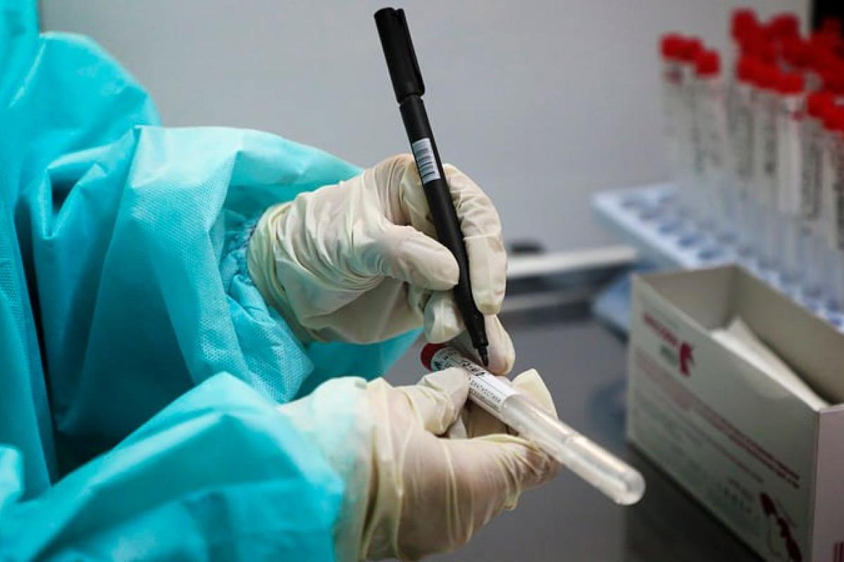 На Луганщине зафиксировано 9 новых случаев COVID-19