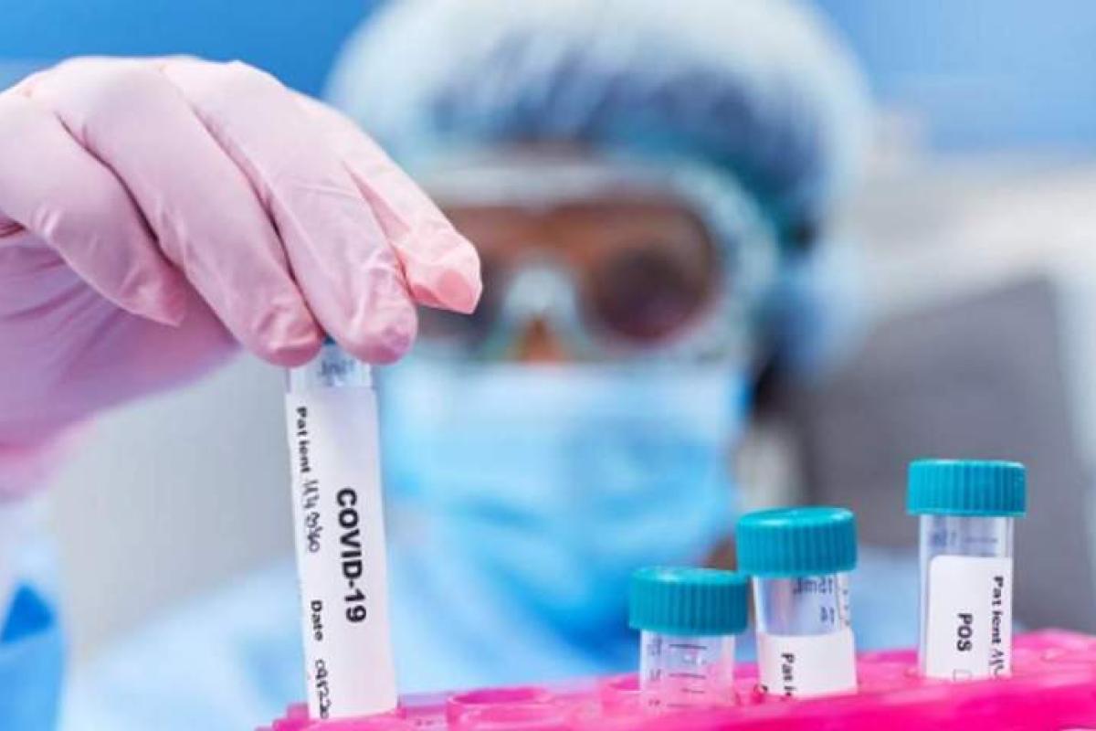 В Минздраве рассказали, когда ситуация с COVID-19 стабилизируется В Минздраве рассказали, когда ситуация с COVID-19 стабилизируется