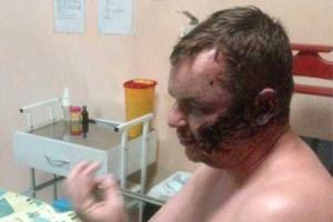 Лидер «Автомайдана» обвинил в своем похищении «русский спецназ»