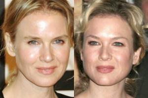 Рене Зеллвегер никогда не мечтала стать матерью, но мечтает о новой фигуре