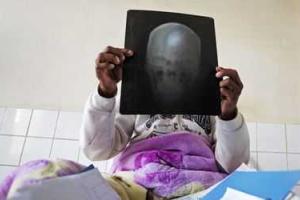 Итальянский хирург планирует операцию по пересадке головы