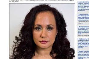 Женщина 40 лет ходит с "каменным" лицом, чтобы выглядеть моложе