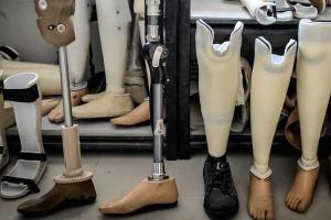 Стартовал "Проект поддержки протезирования в Украине"