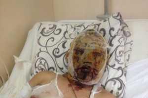 Был нужен, пока убивал на Донбассе: раненый российский "доброволец" пытается выжить