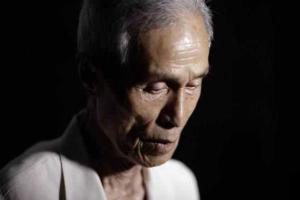 Старый японец показал шрамы, полученные "на память" о взрыве атомной бомбы