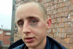 На Сумщине радикалами избит кандидат в депутаты райсовета - Оппозиционный блок