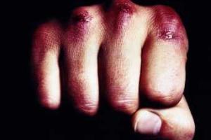 В Киеве водитель-нарушитель избил дворника, осмелившегося сделать ему замечание