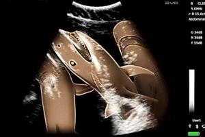 Ученые показали, как выглядят детеныши акулы до рождения на свет