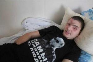 Степова: кто после войны будет содержать покалеченных "ветеранов Новороссии"?