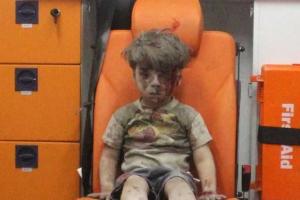 В Алеппо от ранений умер старший брат мальчика, чей снимок шокировал весь цивилизованный мир - СМИ