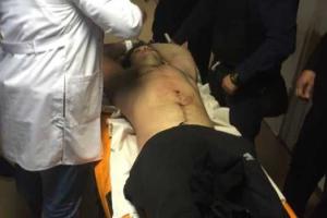 Убийца полицейских находится в реанимации: экс-торнадовцу проводится повторная операция