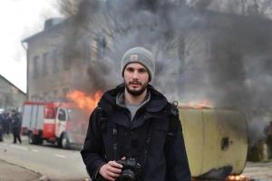 Британский журналист, раненый в Авдеевке, разместил в Facebook первые фото после сложной операции