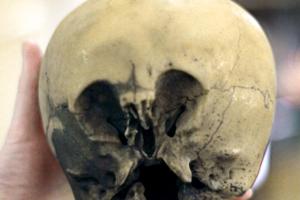 Ученые считают, что череп "звездного" ребенка из Мексики доказывает существование внеземной жизни