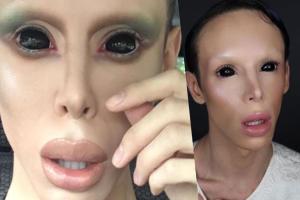 Американец мечтает превратиться в инопланетянина: уже проведено более 110 пластических операций