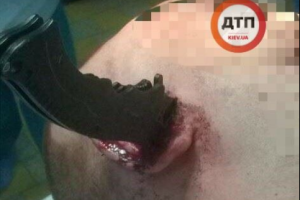 "Нож вошел в ухо по самую рукоятку": В Киеве совершено зверское нападение на мужчину