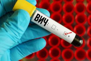 Прорыв в лечении ВИЧ: разработана действенная экспериментальная вакцина