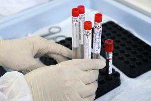 Коронавирус не отступает: в Украине за сутки 477 ​​​​​​​новых случаев COVID-19, данные по регионам