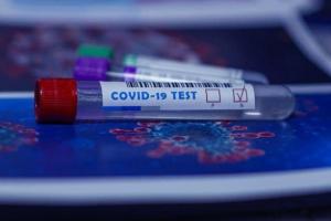 Новый случай COVID-19 Луганщине зафиксирован в Рубежном: контактные лица под наблюдением