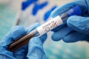 У Луганській області виявлено новий випадок COVID-19