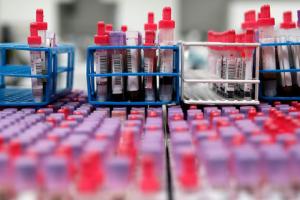 В Україні зростає кількість інфікованих: зафіксовано 848 нових випадків COVID-19