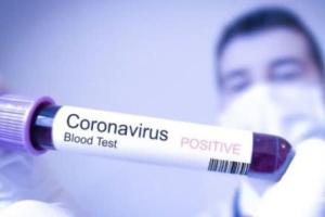 На Луганщині за вихідні виявлено 3 випадки COVID-19: всі - у Сєвєродонецьку