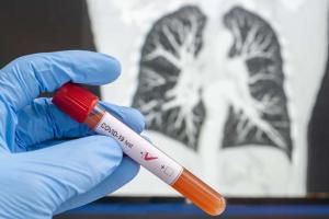 В Украине за сутки выявлено 1 199 новых больных COVID-19