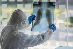 Новий антирекорд: В Україні за добу зафіксовано 1318 нових випадків COVID-19