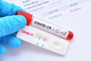 На Луганщині зафіксовано 8 випадків COVID-19 за вихідні: 6 хворих виявлено за минулу добу