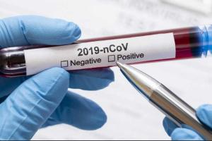 COVID-19 на Луганщині: зафіксовано 105 нових випадків та 4 смерті