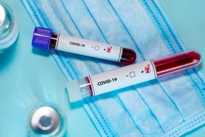 Смерть у Лисичанську та понад 50 нових хворих: статистика по COVID-19 на Луганщині