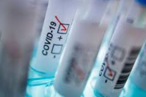 На Луганщине лабораторно подтверждено 50 новых случаев COVID-19