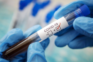 В Україні 417 нових випадків COVID-19 за добу: статистика МОЗ