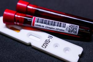 На Луганщине за сутки зафиксировано 759 новых случаев инфицирования COVID-19