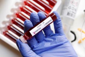 В Україні зростає захворюваність на COVID-19: зафіксовано новий штам коронавірусу FLiRT
