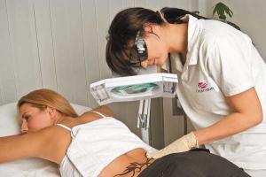 Как избавиться от татуировок и пирсинга